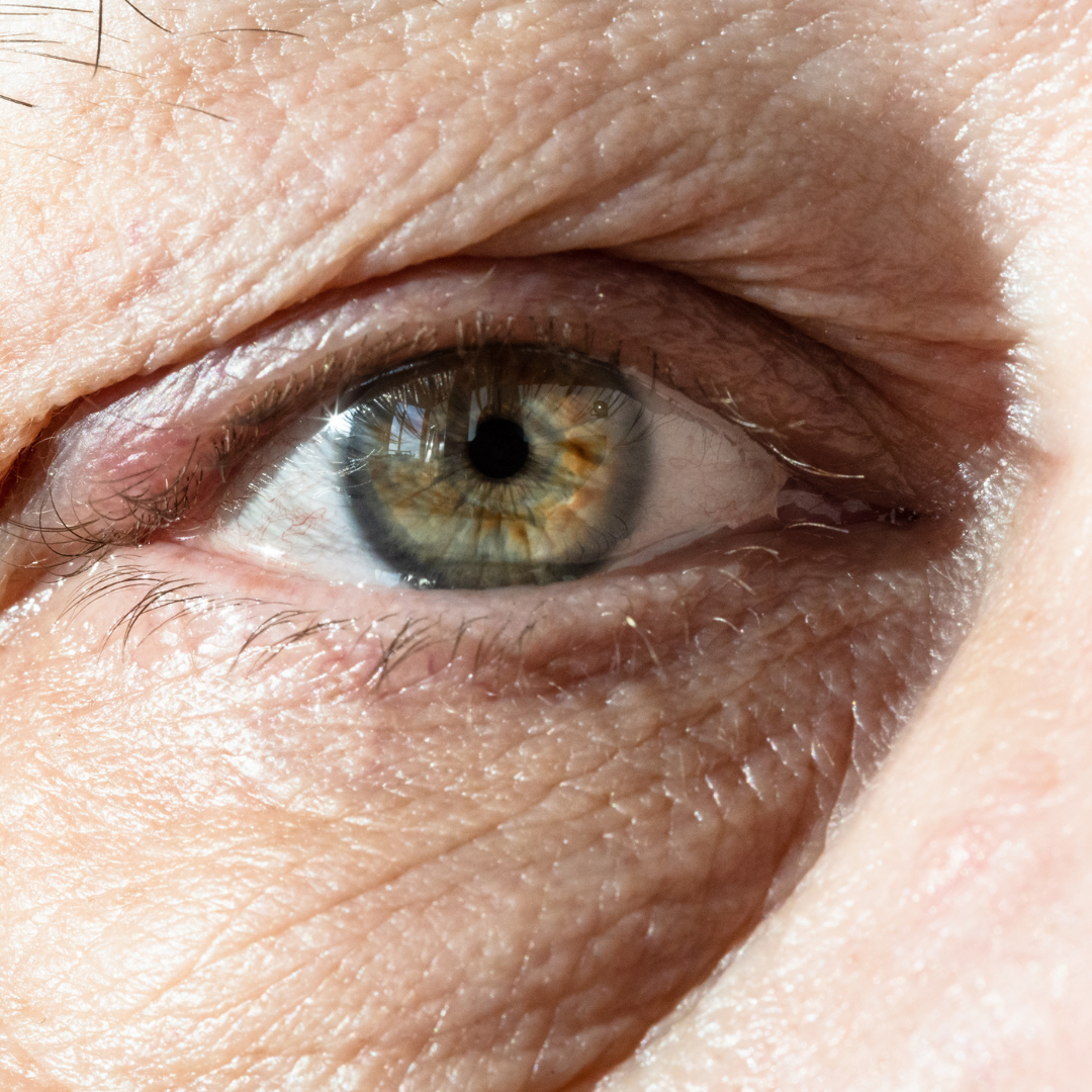 Şeker Hastalarının Göz Tedavisinde Yeni Yöntemler Uygulanıyor