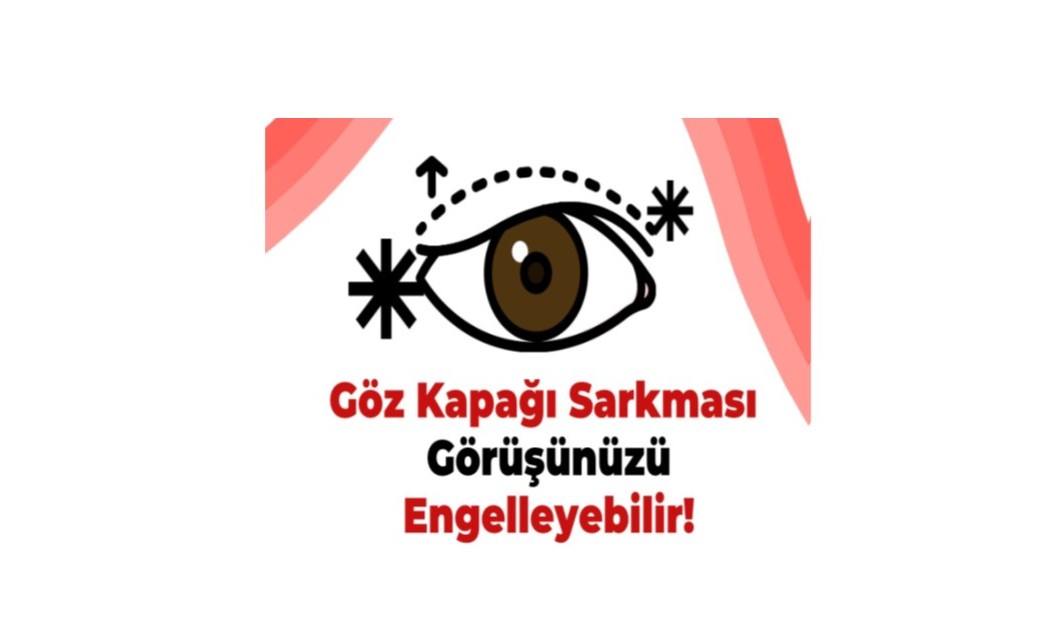 Göz kapağı sarkması görüşünüzü engelleyebilir!