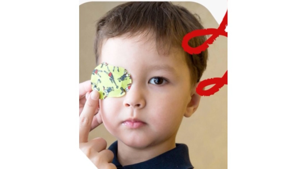 Göz tembelliği nedir?