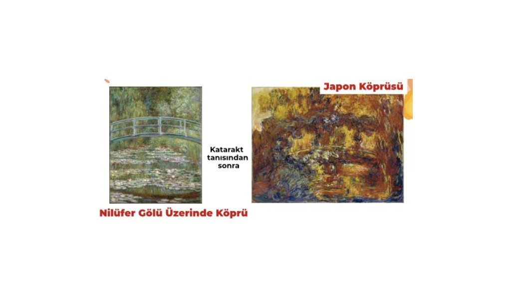 Sanat çoğu zaman gözle ile başlar, duyguyla şekillenir.